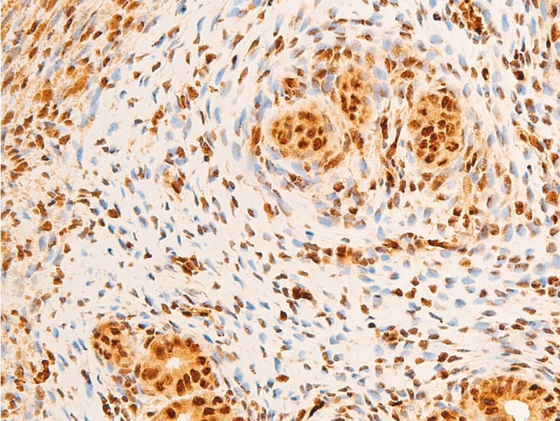 JUN / c-Jun Antibody (phospho-Ser243)