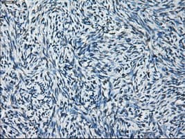 GLUL / Glutamine Synthetase Antibody (clone OTI1F4)