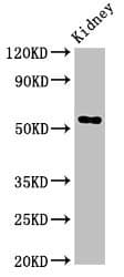 Alpha Fucosidase / FUCA1 Antibody
