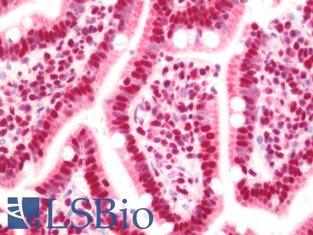 IHC-plus™ Polyclonal Rabbit anti-Human SF3B1 Antibody (aa75-124, IHC, WB)