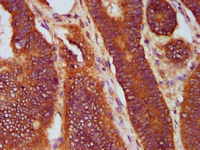 SOS1 Antibody