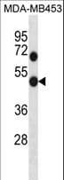Polyclonal Rabbit anti-Human GDI1 Antibody (aa415-443, WB)