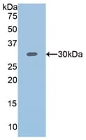 PLS3 / T Plastin Antibody (aa379-630)