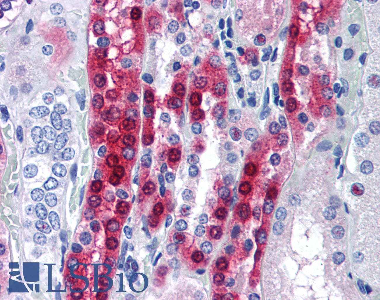 IHC-plus™ PPP1R1A / IPP1 Antibody (aa50-100)
