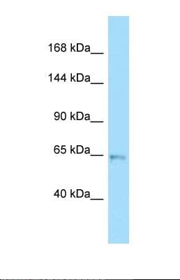 UNC5H3 / UNC5C Antibody (aa121-170)