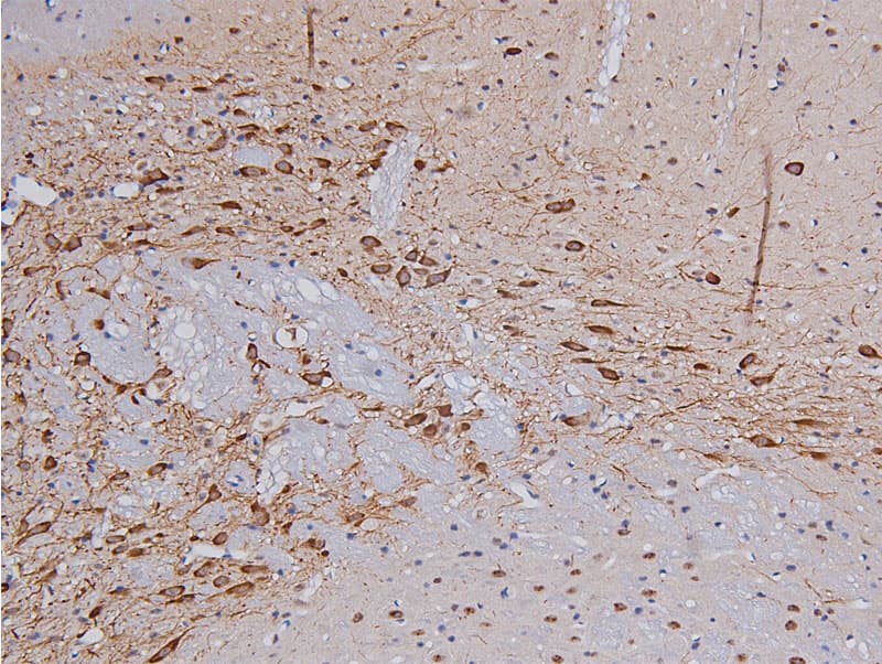 TH / Tyrosine Hydroxylase Antibody (phospho-Ser31)