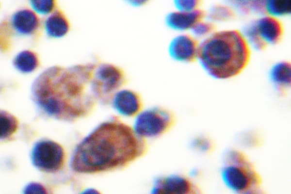 Polyclonal Rabbit anti-Human IL9R / CD129 Antibody (Leu514, IHC)