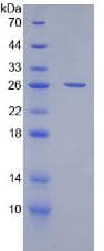 Human CD200 Protein (Recombinant His-T7)