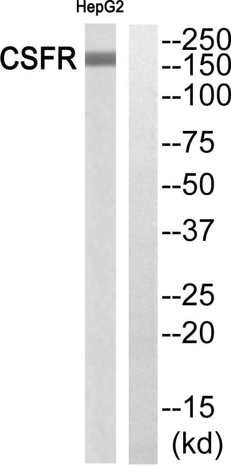 CSF1R / CD115 / FMS Antibody (Ab-699)