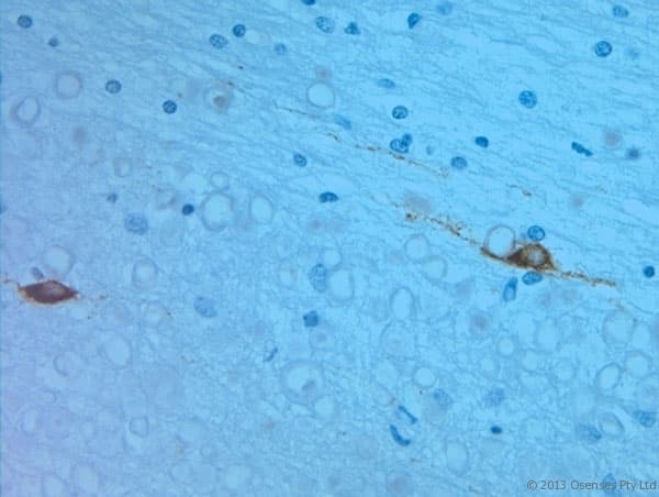 REEP6 Antibody (aa2-50)