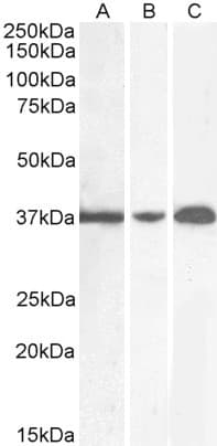 IHC-plus™ Polyclonal Goat anti-Human GAPDH Antibody (aa279-290, IHC, IF, WB)