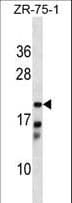 Polyclonal Rabbit anti-Human CBR4 Antibody (aa178-205, WB)