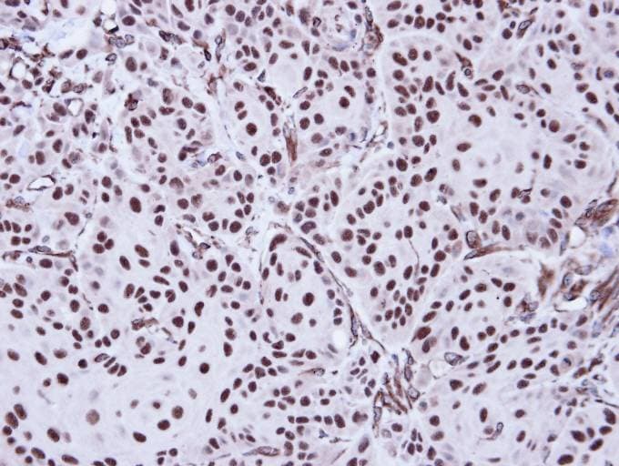 Polyclonal Rabbit anti-Human AEN Antibody (aa236-325, IHC, WB)