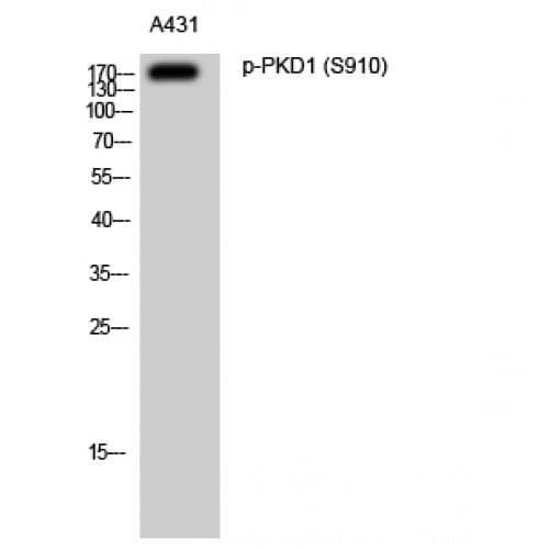 Polyclonal Rabbit anti-Human PRKD1 / PKC Mu Antibody (850-930 aa, WB)