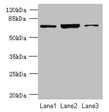 CCDC116 Antibody (Coiled-coil domain)