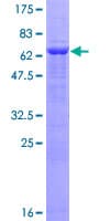 Human ETNK2 Protein (Recombinant GST)