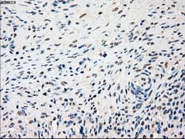 SSB / La Antibody (clone OTI3H9)