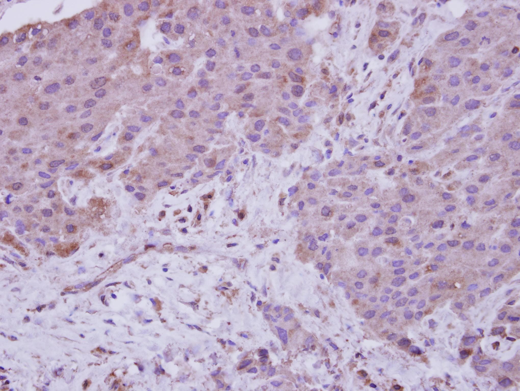 NARG1 / NAA15 Antibody (C-Terminus)