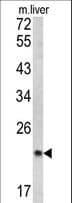 SPCS3 Antibody (aa152-180)