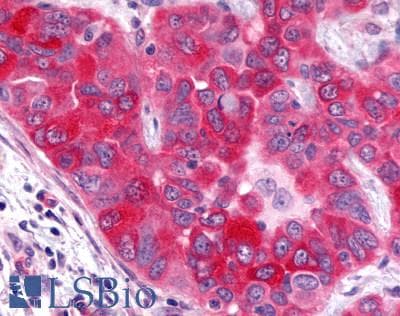 PathPlus™ Polyclonal Rabbit anti-Human GPR17 Antibody (N-Terminus, IHC)