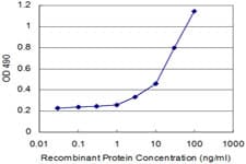 IHC-plus™ RHOA Antibody (clone 1C1)