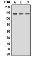 Polyclonal Rabbit anti-Human HTATSF1 / TAT-SF1 Antibody (IHC, WB)