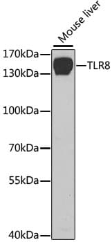 Polyclonal Rabbit anti-Human TLR8 Antibody (IHC, IF, WB)