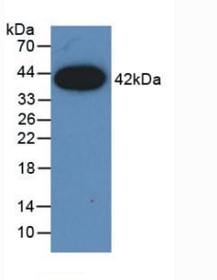 CCL2 / MCP1 Antibody