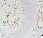 Monoclonal Mouse Anti-Human Kappa Light Chain Secondary Antibody (IHC)