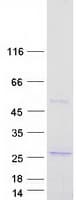 Human CAPSL Protein (Recombinant Myc-DDK (Flag))