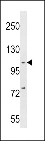 NFKB1 / NF-Kappa-B Antibody (aa911-937)