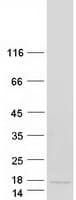 Human SAA1 / SAA / Serum Amyloid A Protein (Recombinant Myc-DDK (Flag))