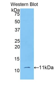 IDO2 / INDOL1 Antibody (aa106-190)