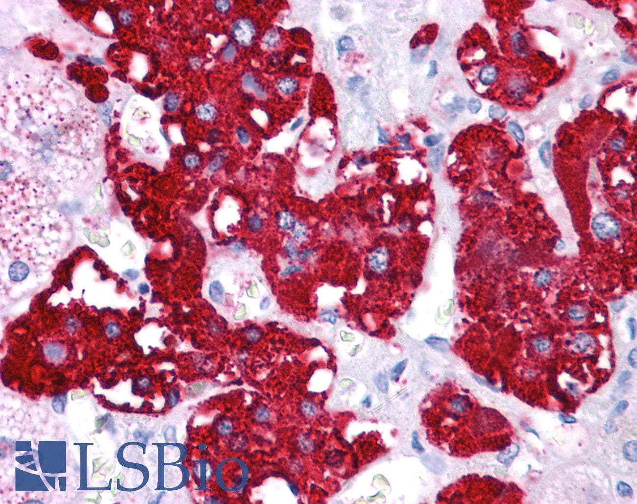 Polyclonal Rabbit anti-Human NR4A2 / NURR1 Antibody (N-Terminus, IHC, WB)
