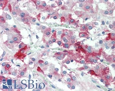 IHC-plus™ TMEFF2 Antibody