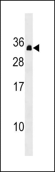 Polyclonal Rabbit anti-Human PDCD10 Antibody (aa96-124, WB)