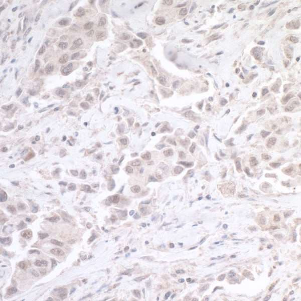 CTCF Antibody (aa650-700)