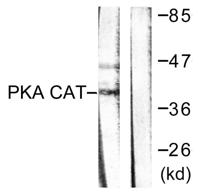 PRKAR2A/B Antibody (p197)