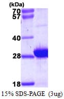 Human MYL6B Protein (Recombinant His)