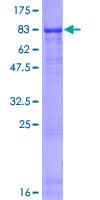 Human THSD4 Protein (Recombinant GST)