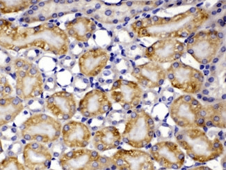 CCT8 Antibody