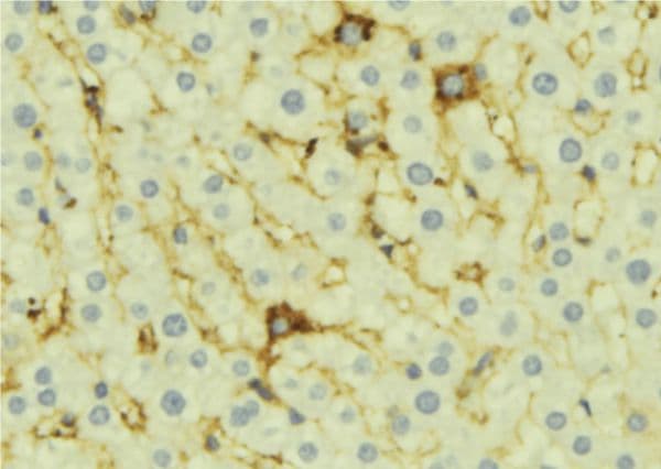 OPTN / Optineurin Antibody