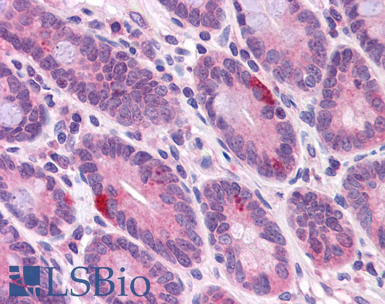 IHC-plus™ SYNGR2 / Synaptogyrin 2 Antibody
