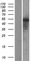 Human WNT5A Protein (Over-Expression Lysate Myc-DDK (Flag))