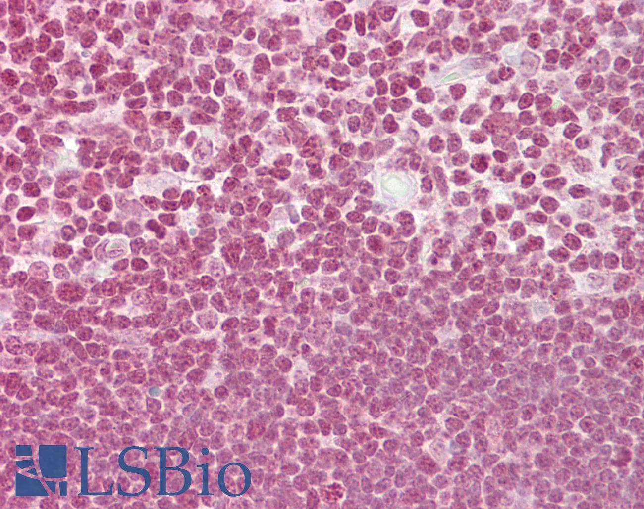 IHC-plus™ E2F1 Antibody (Internal)
