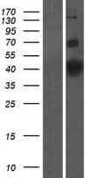 KCNAB1 Protein (Over-Expression Lysate Myc-DDK (Flag))