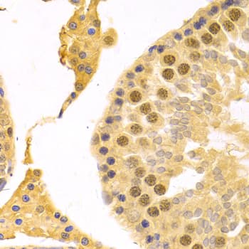 Polyclonal Rabbit anti-Human RFC4 Antibody (IHC, IF, WB)
