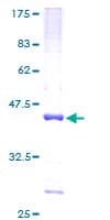Human ETV3 Protein (Recombinant GST)