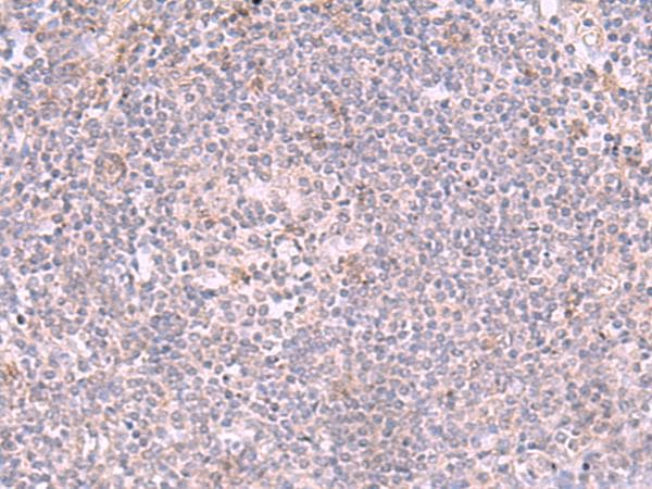INPP5K / SKIP Antibody