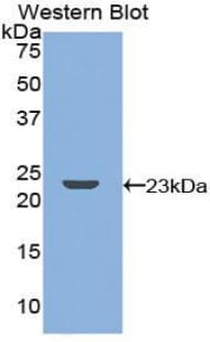 TNFRSF11A / RANK Antibody (aa359-542, APC)